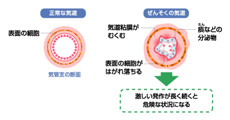 医療情報｜交通案内｜北九州市若松区の内科・呼吸器内科・循環器内科。藤ノ木駅近く。